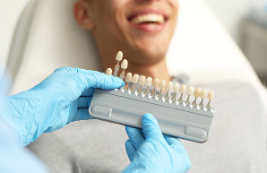 e-max veneers