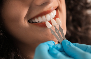 zirconia veneers