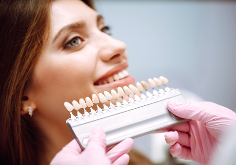 EMAX Veneers